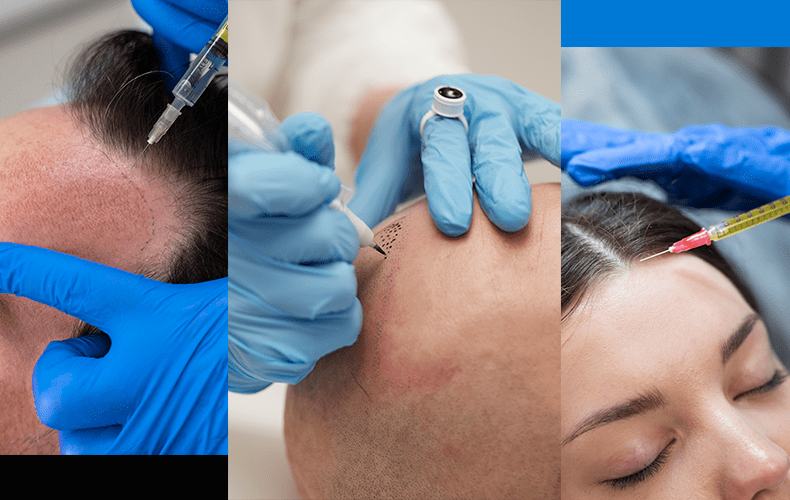Preguntas frecuentes de Dermatología y Medicina Capilar en Panamá – Tricoderm Clinic